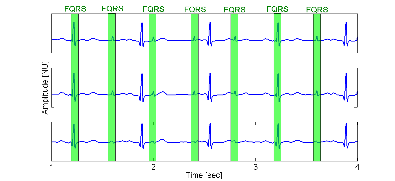 Signal example