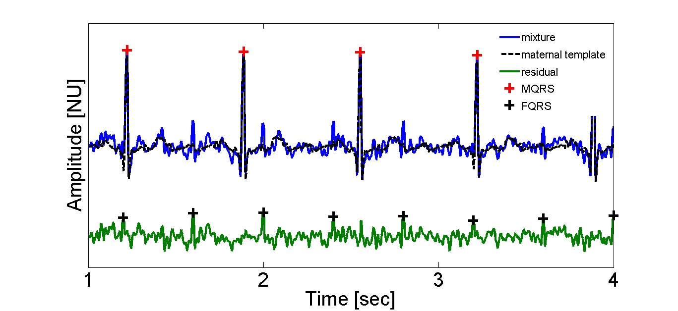 Signal example